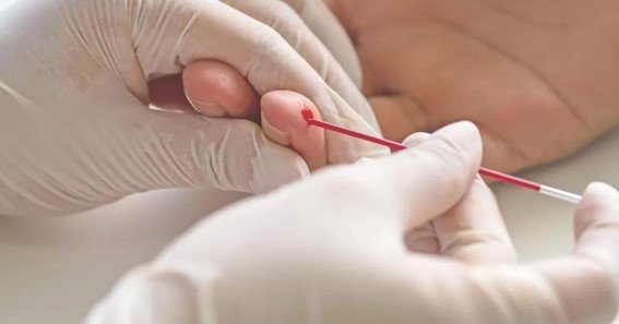 What Can Affect PCV Levels