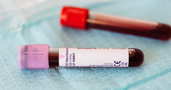 What Do High Or Low PCV Levels Mean