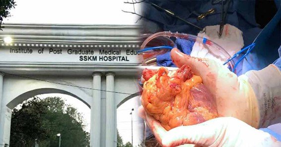 Why Is SSKM Hospital Well-Known